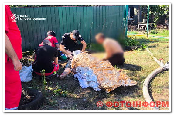 На Кіровоградщині під час пожежі у будинку травмувався чоловік та загинула жінка (ФОТО)